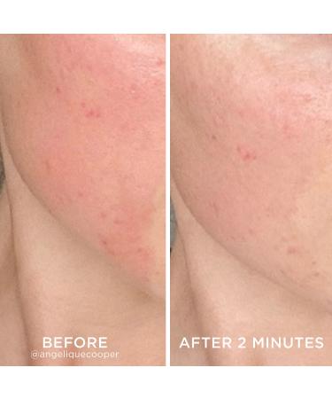Shop Dr. Brandt Skincare Cool Biotic Prebiotic Redness Relief Cream - 1.7 oz/ 48 g Online - Best Price & International Shipping - Buy Online on GoSupps.com