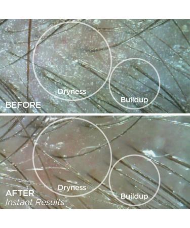 Shop BeautyBio GloPRO SCALP MicroTip Attachment Head Online - Best Price & International Shipping - Buy Online on GoSupps.com