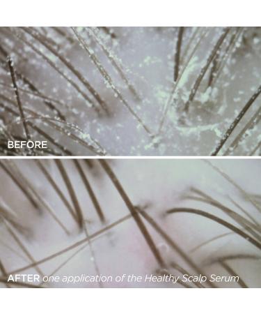 Shop BeautyBio Healthy Scalp Serum & Hair Density Treatment with Camellia Leaf - 1.7 oz/ 50 mL Online - Best Price & International Shipping - Buy Online on GoSupps.com