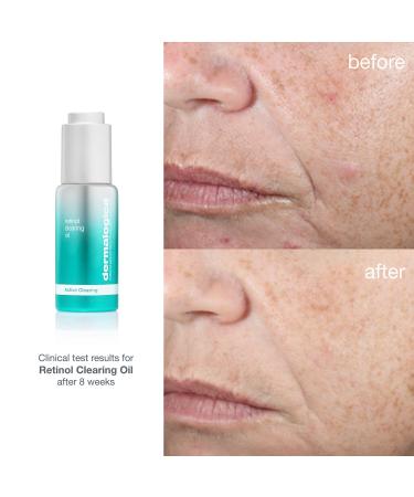 Shop Dermalogica Retinol Acne Clearing Oil - 1 oz/ 30 mL Online - Best Price & International Shipping - Buy Online on GoSupps.com