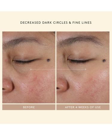 Shop Shani Darden Skin Care Intensive Eye Renewal Cream with Firming Peptides - 0.5 oz/ 15 mL Online - Best Price & International Shipping - Buy Online on GoSupps.com