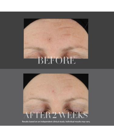 Shop Kate Somerville KateCeuticals Firming Serum with Hyaluronic Acid - 1 oz/ 30 mL Online - Best Price & International Shipping - Buy Online on GoSupps.com