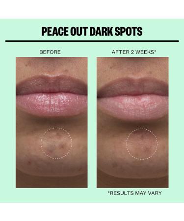 Shop Peace Out Microneedling Dark Spot Brightening Dots Online - Best Price & International Shipping - Buy Online on GoSupps.com