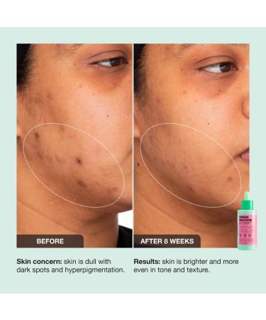 Shop iNNBEAUTY PROJECT Green Machine Vitamin C Dark Spot & Hyperpigmentation Serum - 1 oz/ 30 mL Online - Best Price & International Shipping - Buy Online on GoSupps.com