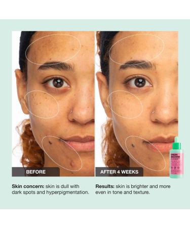 Shop iNNBEAUTY PROJECT Green Machine Vitamin C Dark Spot & Hyperpigmentation Serum - 1 oz/ 30 mL Online - Best Price & International Shipping - Buy Online on GoSupps.com