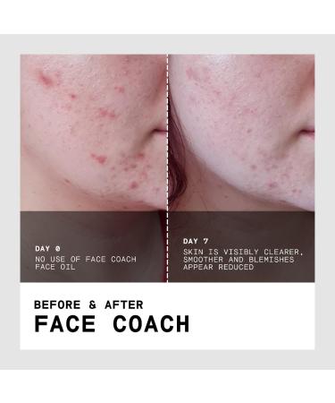 Shop FaceGym Face Coach Lifting Squalane Face Oil - 1 oz/ 30 mL Online - Best Price & International Shipping - Buy Online on GoSupps.com
