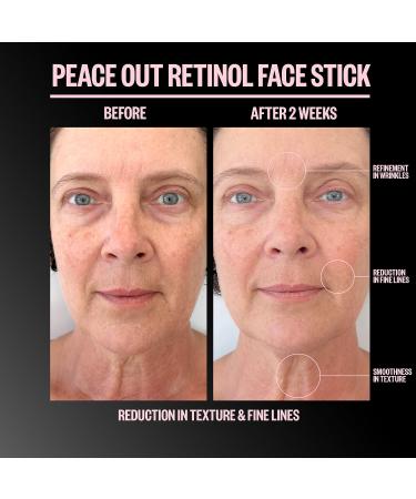 Shop Peace Out Retinol Face Stick - .28 oz / 8 g Online - Best Price & International Shipping - Buy Online on GoSupps.com