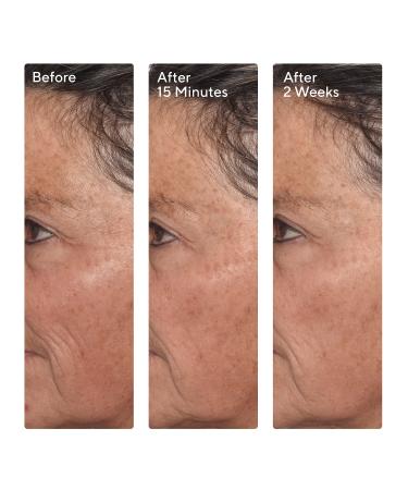 Shop Murad Targeted Wrinkle Corrector Online - Best Price & International Shipping - Buy Online on GoSupps.com