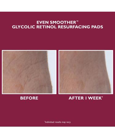 Shop Peter Thomas Roth Even Smoother Glycolic Retinol Resurfacing Peel Pads Online - Best Price & International Shipping - Buy Online on GoSupps.com