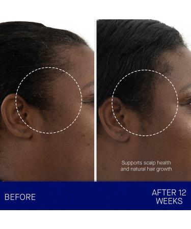 Shop Augustinus Bader The Scalp Treatment - 1 oz/ 30 mL Online - Best Price & International Shipping - Buy Online on GoSupps.com