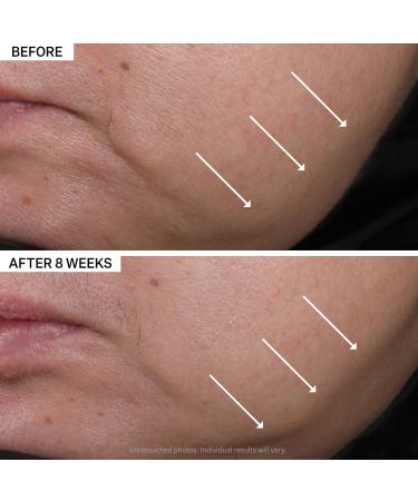 Shop StriVectin Contour Restore Tightening & Sculpting Moisturizing Face Cream - 1.7 oz/ 50 mL Online - Best Price & International Shipping - Buy Online on GoSupps.com