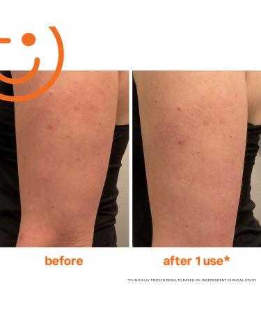 Shop Kate Somerville ExfoliKate Resurfacing Body Scrub with AHA BHA & Caffeine - 5 oz/ 150 mL Online - Best Price & International Shipping - Buy Online on GoSupps.com