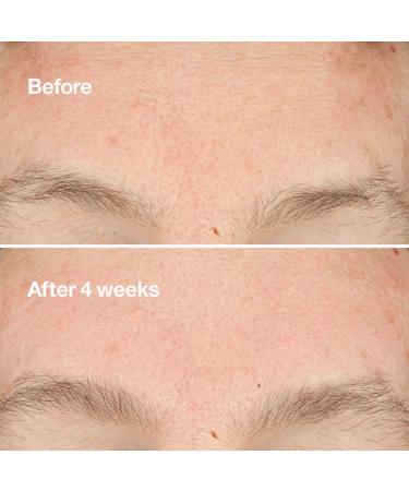 Shop CLINIQUE Clarifying Do-Over Peel - 1 oz/ 30 mL Online - Best Price & International Shipping - Buy Online on GoSupps.com