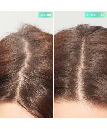 Shop The INKEY List Glycolic Acid Exfoliating Scalp Scrub - 5 oz / 150 mL Online - Best Price & International Shipping - Buy Online on GoSupps.com