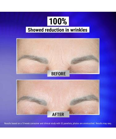 Shop Kiehl's Since 1851 Retinol Fast-Release Wrinkle Reducing Night Serum - 1 oz / 30 mL Online - Best Price & International Shipping - Buy Online on GoSupps.com