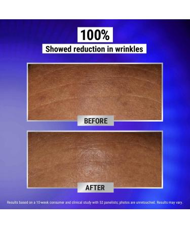 Shop Kiehl's Since 1851 Retinol Fast-Release Wrinkle Reducing Night Serum - 1 oz / 30 mL Online - Best Price & International Shipping - Buy Online on GoSupps.com