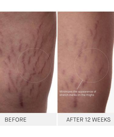 Shop Augustinus Bader The Body Cream - 6.8 oz / 200 mL Online - Best Price & International Shipping - Buy Online on GoSupps.com