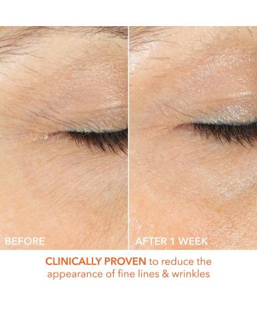 Shop Dr. Dennis Gross Skincare Vitamin C Lactic Firm & Bright Eye Treatment - 0.5 oz / 15 mL Online - Best Price & International Shipping - Buy Online on GoSupps.com