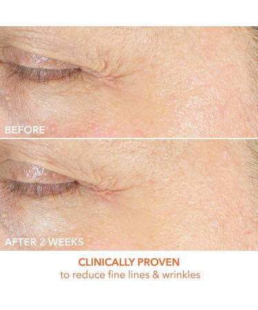 Shop Dr. Dennis Gross Skincare Vitamin C Lactic Firm & Bright Eye Treatment - 0.5 oz / 15 mL Online - Best Price & International Shipping - Buy Online on GoSupps.com