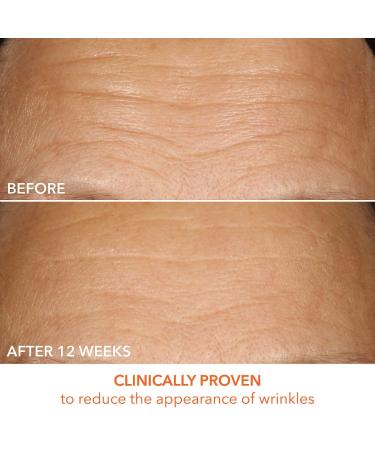 Shop Dr. Dennis Gross Skincare Vitamin C Lactic 15% Firm & Bright Serum - 1 oz / 30 mL Online - Best Price & International Shipping - Buy Online on GoSupps.com