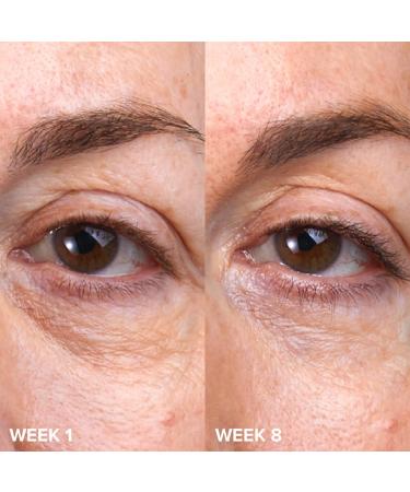 Shop Paula's Choice C5 Super Boost Vitamin C Eye Cream - 0.5 oz / 15 mL Online - Best Price & International Shipping - Buy Online on GoSupps.com