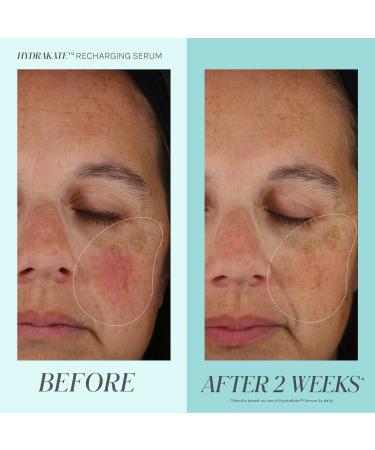 Shop Kate Somerville HydraKate Recharging Serum with Hyaluronic Acid - 1 oz / 30 mL Online - Best Price & International Shipping - Buy Online on GoSupps.com