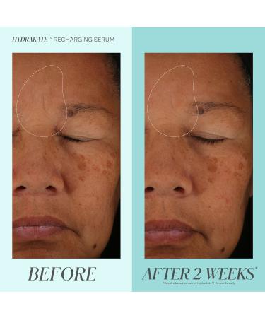 Shop Kate Somerville HydraKate Recharging Serum with Hyaluronic Acid - 1 oz / 30 mL Online - Best Price & International Shipping - Buy Online on GoSupps.com