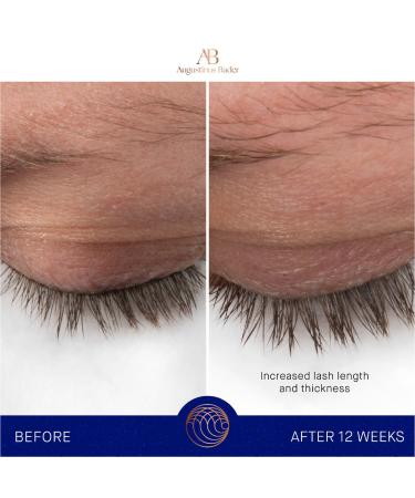 Shop Augustinus Bader The Eyebrow & Lash Enhancing Serum - 0.3 oz / 8 mL Online - Best Price & International Shipping - Buy Online on GoSupps.com