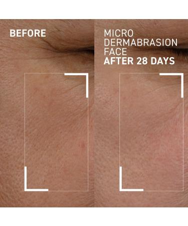 Shop Dr. Brandt Skincare Mini Microdermabrasion Renewing Age-Defying Face Exfoliator - .7 oz / 20 g Online - Best Price & International Shipping - Buy Online on GoSupps.com