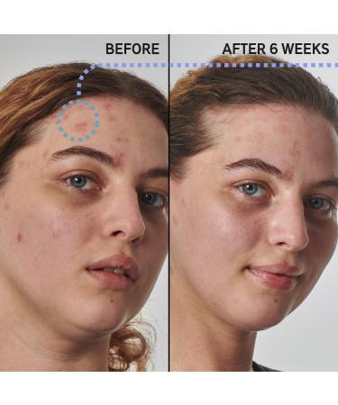 Shop The INKEY List SuperSolutions 10% Urea Moisturizer Textured Skin Solution - 1.7 oz / 50 mL Online - Best Price & International Shipping - Buy Online on GoSupps.com