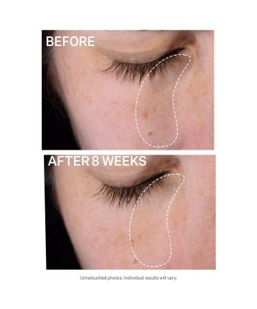 Shop StriVectin Super-C Dark Circle Brightening Eye Serum - 0.5 oz / 15 mL Online - Best Price & International Shipping - Buy Online on GoSupps.com