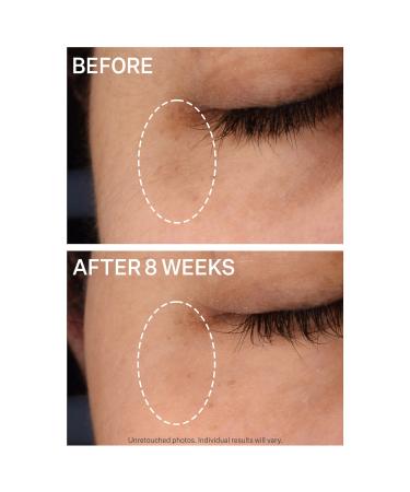 Shop StriVectin Super-C Dark Circle Brightening Eye Serum - 0.5 oz / 15 mL Online - Best Price & International Shipping - Buy Online on GoSupps.com