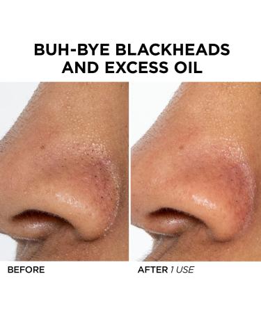 Shop BeautyBio GLOfacial Hydro-Infusion Pore Cleansing + Blue LED Clarifying Tool Online - Best Price & International Shipping - Buy Online on GoSupps.com