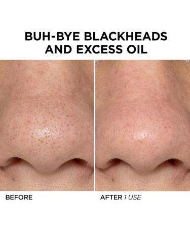 Shop BeautyBio GLOfacial Hydro-Infusion Pore Cleansing + Blue LED Clarifying Tool Online - Best Price & International Shipping - Buy Online on GoSupps.com