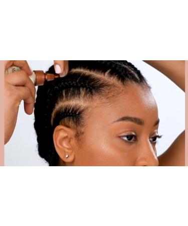 Shop Mizani Scalp Care Soothing Scalp Lotion Online - Best Price & International Shipping - Buy Online on GoSupps.com