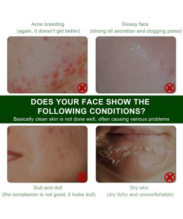 Green Tea Stick Mask for Deep Cleanse  Acne & Blackhead Control - Buy Online on GoSupps.com