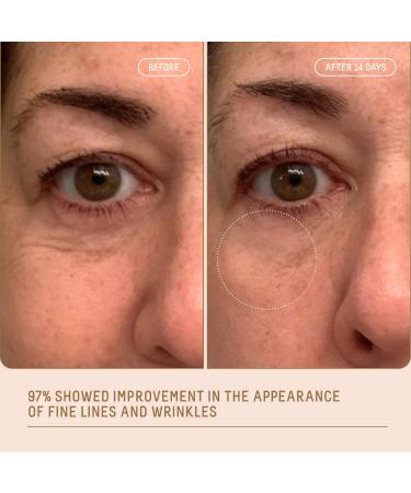 Shop Biossance Squalane + Marine Algae Eye Cream for Fine Lines & Dark Circles - 0.5 oz / 15 mL Online - Best Price & International Shipping - Buy Online on GoSupps.com