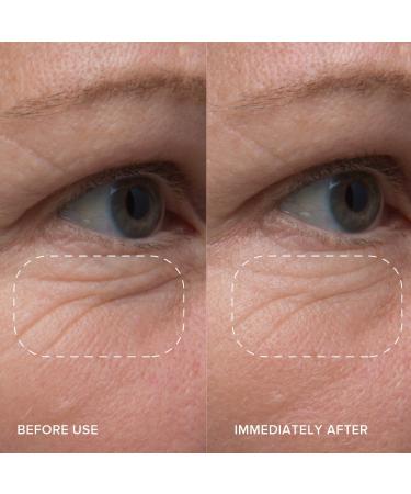 Shop Alpyn Beauty Line-Filling Eye Cream with Bakuchiol and Caffeine - 0.5 oz/ 14 mL Online - Best Price & International Shipping - Buy Online on GoSupps.com