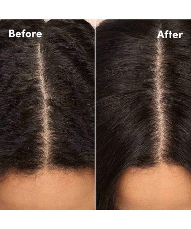 Shop Mizani Scalp Care Anti-Dandruff Shampoo Online - Best Price & International Shipping - Buy Online on GoSupps.com