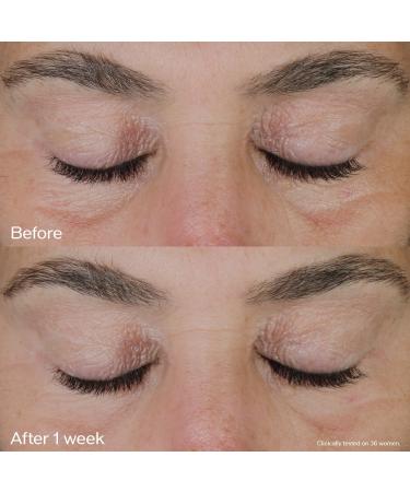 Shop Shiseido Vital Perfection Uplifting and Firming Eye Cream - 0.5 oz/ 15 mL Online - Best Price & International Shipping - Buy Online on GoSupps.com