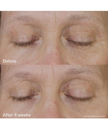 Shop Shiseido Vital Perfection Uplifting and Firming Eye Cream - 0.5 oz/ 15 mL Online - Best Price & International Shipping - Buy Online on GoSupps.com