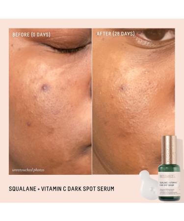 Shop Biossance Squalane + 10% Vitamin C Dark Spot Serum - 1.0 oz/ 30 mL Online - Best Price & International Shipping - Buy Online on GoSupps.com