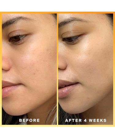 Shop Supergoop! Daily Dose Vitamin C Serum Sunscreen with SPF 40 - 1.0 oz/ 30 mL Online - Best Price & International Shipping - Buy Online on GoSupps.com