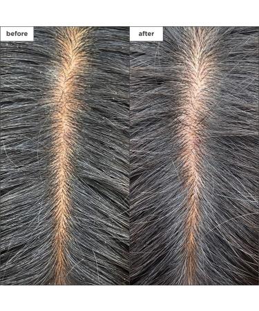 Shop Briogeo Scalp Revival Charcoal + Tea Tree Cooling Hydration Mask for Dry Itchy Scalp - 6 oz/ 177 mL Online - Best Price & International Shipping - Buy Online on GoSupps.com