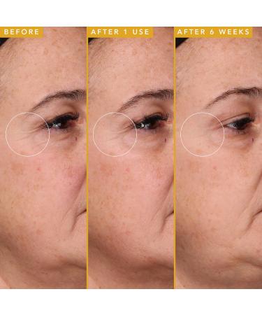 Shop Farmacy Filling Good Hyaluronic Acid Plumping Serum - 1.0 oz/ 30 mL Online - Best Price & International Shipping - Buy Online on GoSupps.com