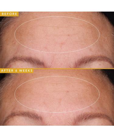 Shop Farmacy Filling Good Hyaluronic Acid Plumping Serum - 1.0 oz/ 30 mL Online - Best Price & International Shipping - Buy Online on GoSupps.com