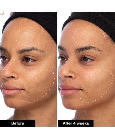 Shop iNNBEAUTY PROJECT Slushy Serum Moisturizer Crush Infused with Bakuchiol - 1.7 oz/ 50 mL Online - Best Price & International Shipping - Buy Online on GoSupps.com