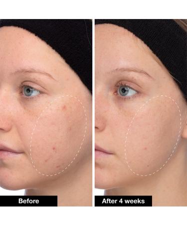 Shop iNNBEAUTY PROJECT Slushy Serum Moisturizer Crush Infused with Bakuchiol - 1.7 oz/ 50 mL Online - Best Price & International Shipping - Buy Online on GoSupps.com