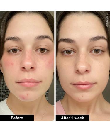 Shop iNNBEAUTY PROJECT Slushy Serum Moisturizer Crush Infused with Bakuchiol - 1.7 oz/ 50 mL Online - Best Price & International Shipping - Buy Online on GoSupps.com