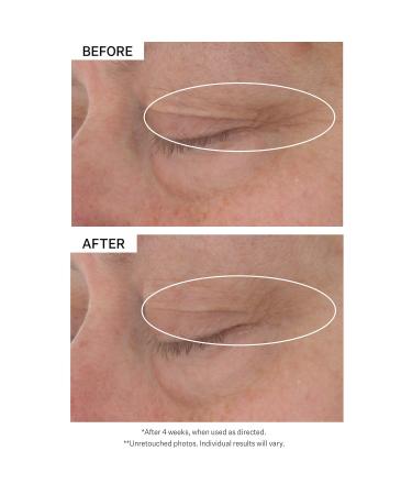 Shop StriVectin Hyaluronic Tripeptide Gel-Cream for Eyes - 0.5 oz / 15 mL Online - Best Price & International Shipping - Buy Online on GoSupps.com